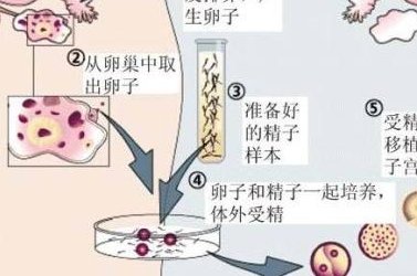 男性死精症做试管成功率揭秘，附上提高成功率的方法大全！